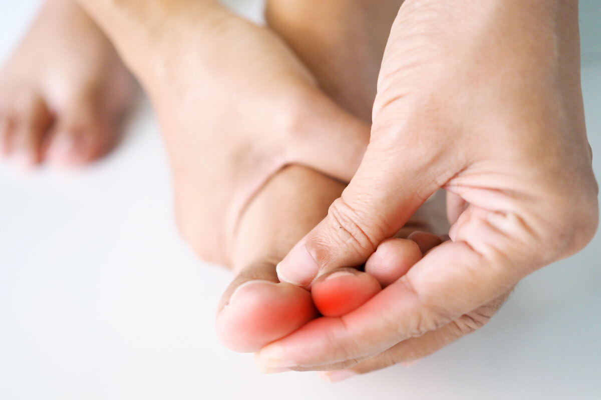 Toe Splints