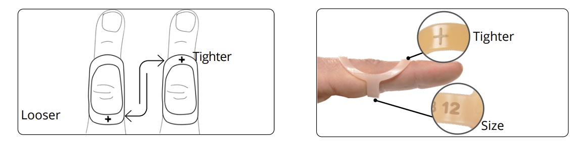 An Oval-8 Finger Splint can be adjusted to loosen or tighten your fit How to correctly adjust the tightness of your finger splint